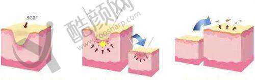 五、邯郸第七医院整形科怎么预约：