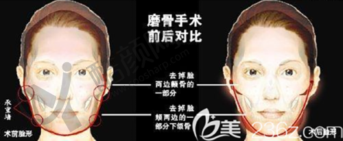 二、长春市绿园区悦美汇医疗美容门诊部正规吗？来看看医院资质：