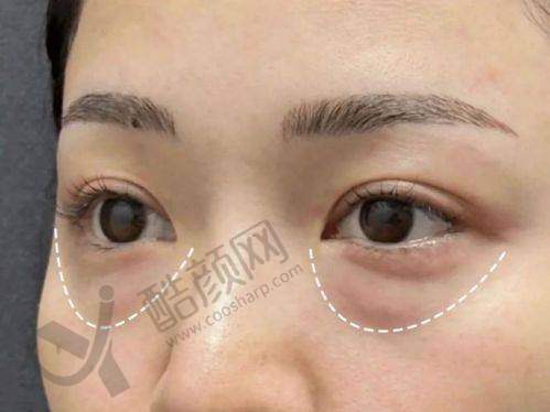 二、北京轻美颜（眼袋提升）医疗美容诊所正规吗？来看看医院资质：