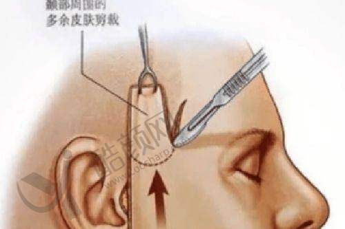 东莞缔美游定良医生:个性化方案成就自然美