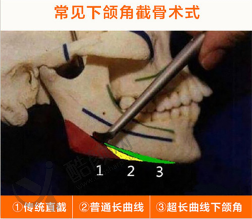 七、成都润美晶肤医疗美容门诊部价格表：（仅供参考）
