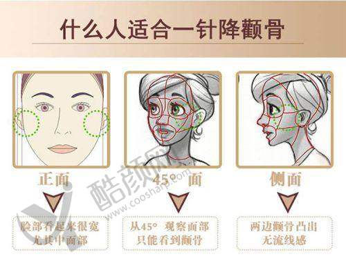 一、成都润美晶肤医疗美容门诊部怎么样？