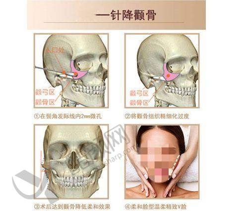 六、成都润美晶肤医疗美容门诊部怎么预约：