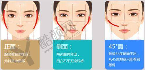 东莞韩美王仁斌医生：一次成形技术优势显著