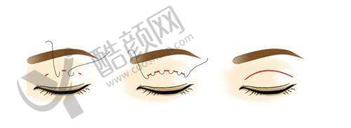 七、郑州东方整形医院价格表：（仅供参考）