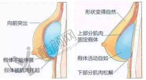 六、山东菏泽御美汇医疗美容怎么预约：