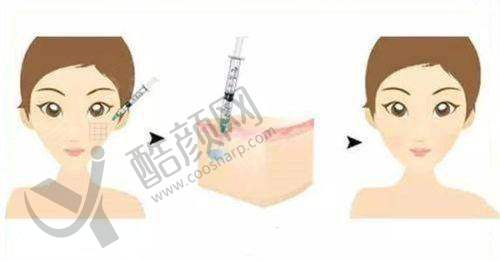 七、山东菏泽御美汇医疗美容价格表：（仅供参考）