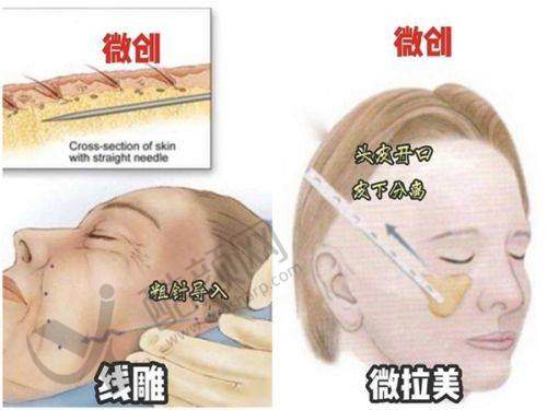 一、山东菏泽御美汇医疗美容怎么样？