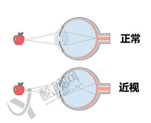 广西晶亮眼科医院是公办的吗?——价格与口碑评价