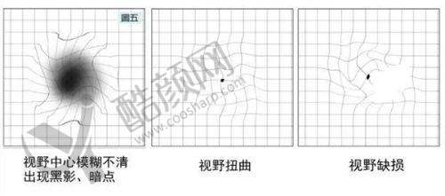 长沙宏朗眼科为啥便宜？收费透明无套路