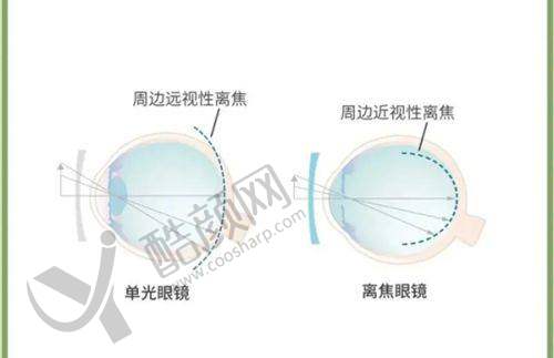阳江爱尔眼科医院与阳江光明医院的技术实力对比