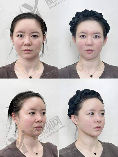 二、上海韩卓医疗美容门诊部正规吗？来看看医院资质：