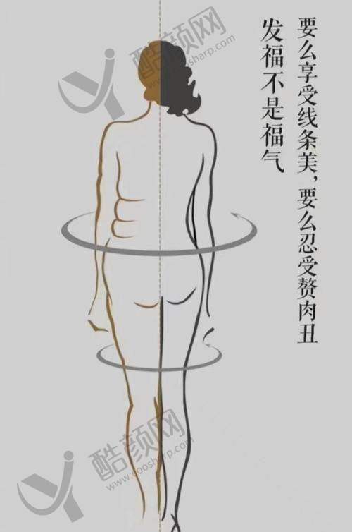 成都西区医院宋华敬抽脂技术：黄金分层术+多技术保护