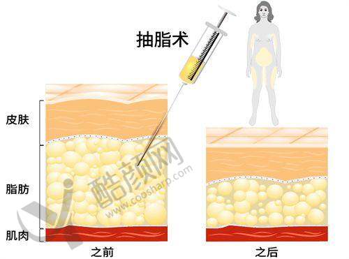 徐淑卿项目价格表参考