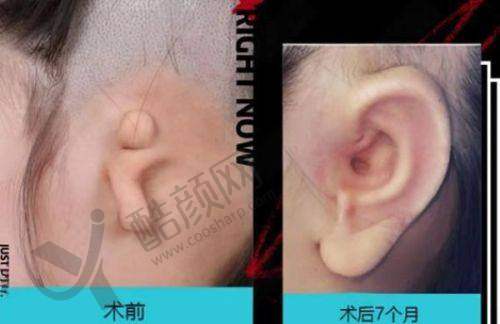 八、南阳第一人民医院医疗美容科真实的顾客评价如下：