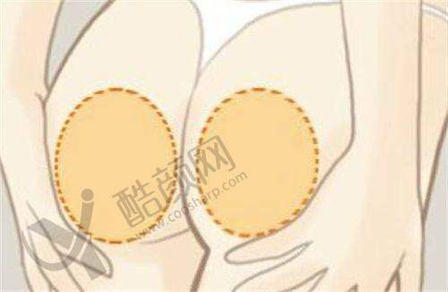 六、沈阳伊美尔医疗美容医院怎么预约：