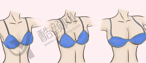 桂林181医院整形科：价格合理，性价比高