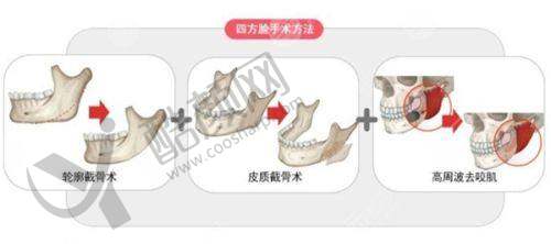 冯少清项目价格表参考