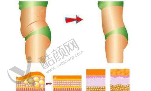 一、河南职工医院整形美容科怎么样？