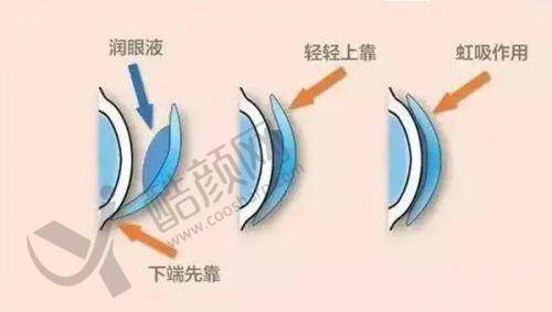 兰州普瑞眼视光医院：专精靠谱的医生团队