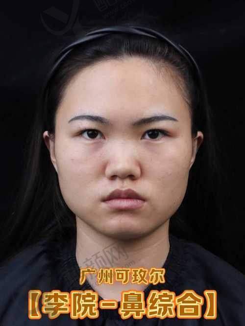 牛永敢鼻修复水平怎么样可靠吗？