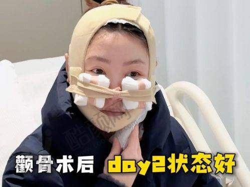 沈阳看颧骨高哪家医院好？沈阳杏林整形外科医院优势多