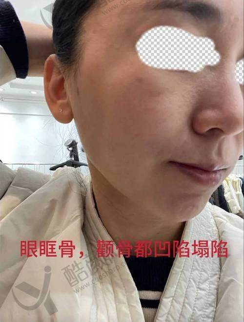 选择沈阳看颧骨高医院的关键要点