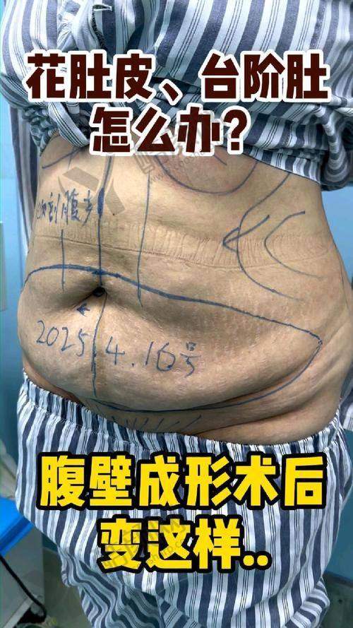 北京画美医疗美容医院