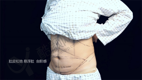 北京华美医疗美容医院
