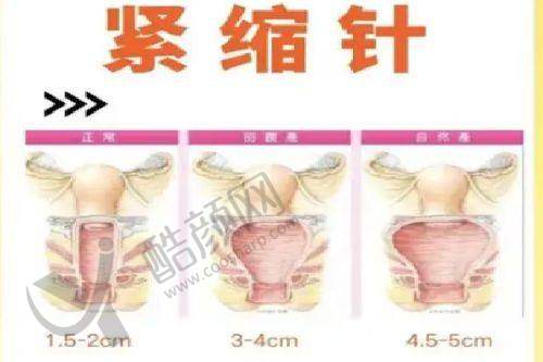 佳木斯韩艺来医疗美容医院的综合优势