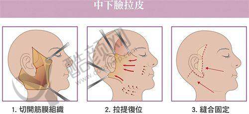 一、郑州圣熙格兰医疗美容门诊部怎么样？