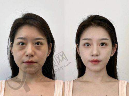 八大处张海明口碑评价