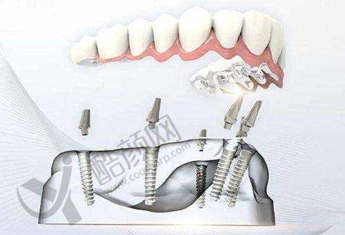 南宁你美医疗美容口腔科的口碑与价格