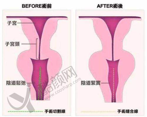 怀化美蒂珂医疗美容的项目与设备