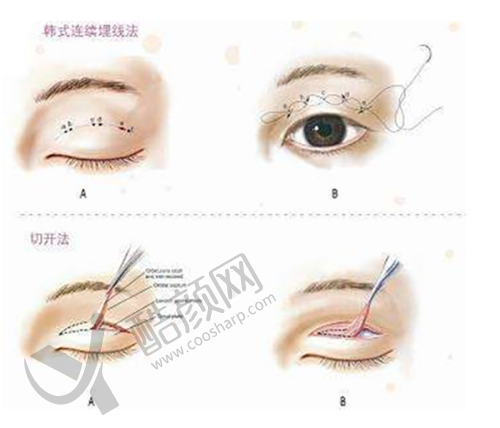 湘西赫美医疗美容的隆鼻成功实例多吗？