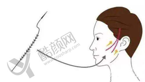 三、承德玥莱美医疗整形医院医生介绍: