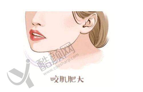 湘西赫美医疗美容的隆鼻价格如何？