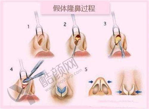 南充韩美整形：独具特色的韩式医美