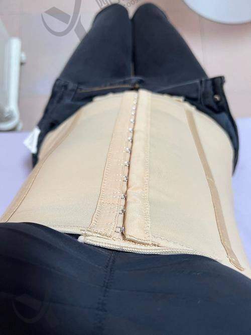 罗明生抽脂水平怎么样可靠吗？