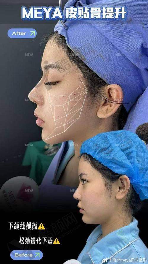 八大处张海明在哪坐诊？现坐美莱等三院，拉皮技术优且口碑佳