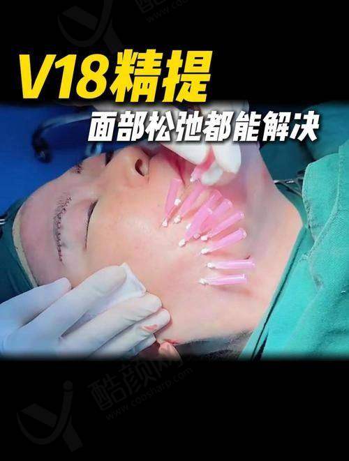 八大处张海明拉皮技术优势