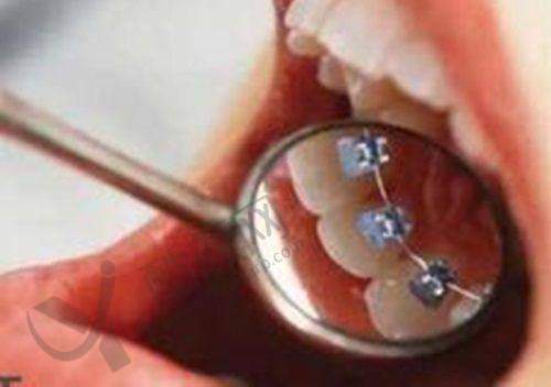 大理拜博口腔医院根管治疗380元起,专业团队精准施治,打造口腔健康新体验