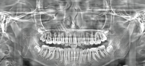 商丘口腔医院镶全瓷牙2600元起,正规团队+透明收费打造高品质口腔诊疗体验