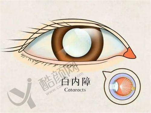 重庆渝州华厦眼科霍妍项目价格表参考
