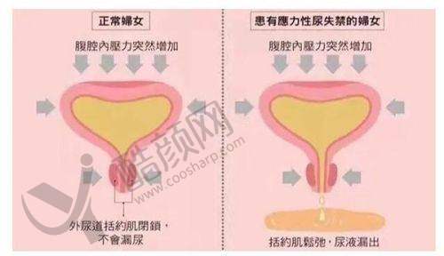 一、吉林华怡整形医院怎么样？