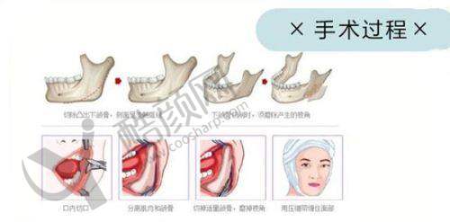 苏州紫馨美容医院的口碑评价