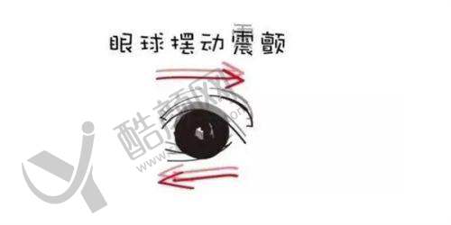 重庆爱成眼科医院半飞秒手术优势