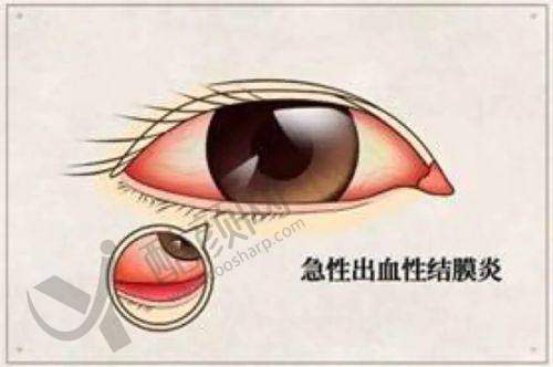 重庆渝州华厦眼科叶剑个人资料及简历