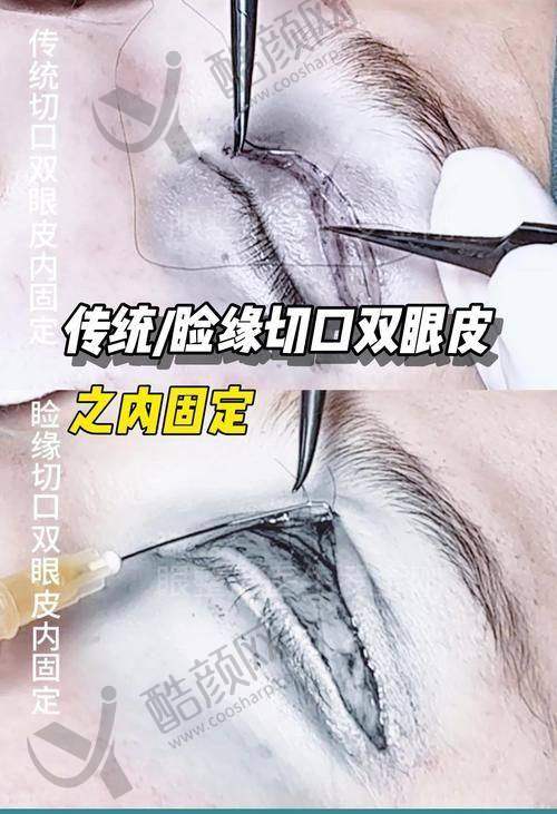 成都艺星韩春院长项目价格表参考