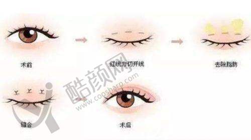 成都八大处整形医院：团队协作实力强劲